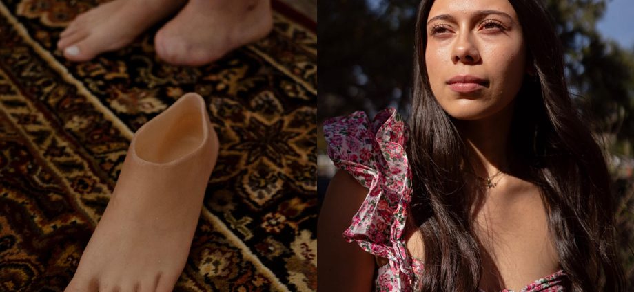 a-college-student-fights-an-insurance-denial-to-get-a-prosthetic-foot-before-graduation