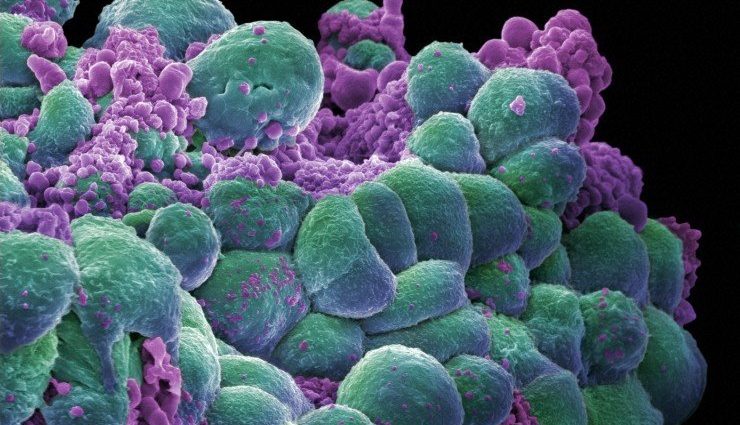 are-claims-linking-recent-us.-trends-in-cancer-diagnoses-to-covid-19-vaccines-plausible?-a-look-at-the-available-data