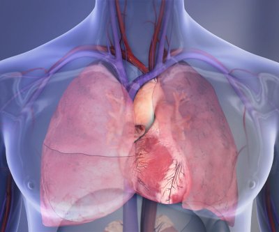 Study: Heart disease, stroke remain leading causes of U.S. deaths