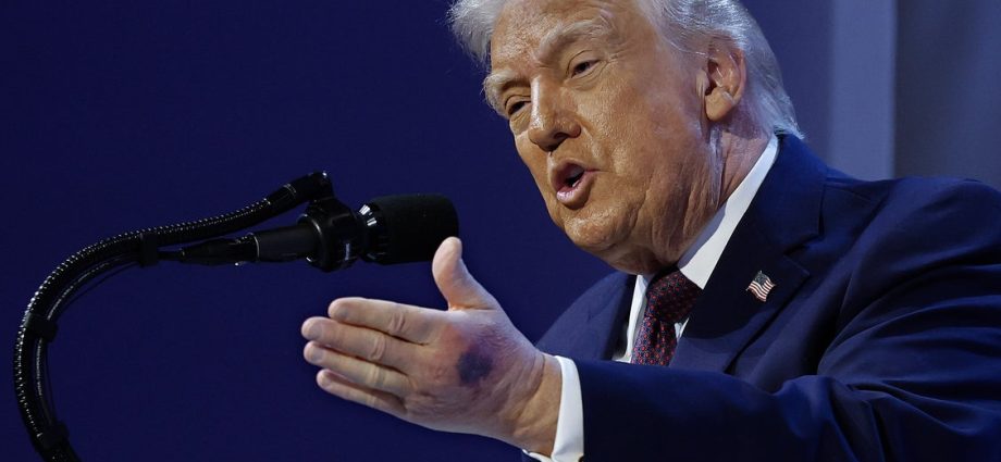 traitor-47-has-yet-another-hand-bruise-—-and-a-sketchy-excuse