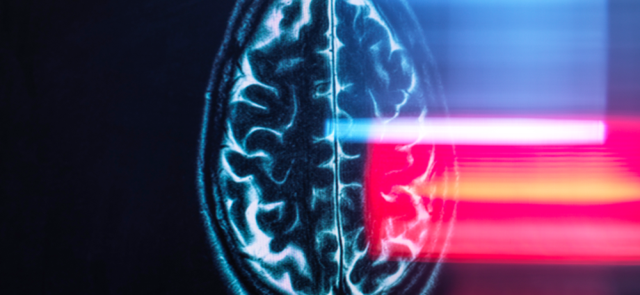 ‘The brain consistently moved upward and backward’: Astronauts’ brains physically shift in their heads during spaceflight