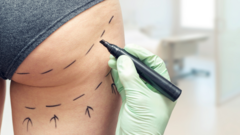 stop-dithering-on-brazilian-butt-lift-crackdown,-say-mps