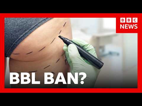 tighter-restrictions-on-brazilian-butt-lift-procedures-needed,-uk-mps-warn-|-bbc-news