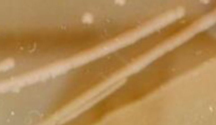 Multidrug-Resistant Bacterial Strain Found Preserved in 5,000-Year-Old Cave Ice