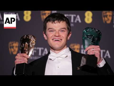 charity-hopes-‘i-swear’-shines-a-light-on-tourette-syndrome-after-bafta-win