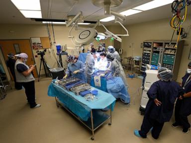 more-organs-are-being-donated-after-the-heart-stops,-not-brain-death.-policies-are-changing-too