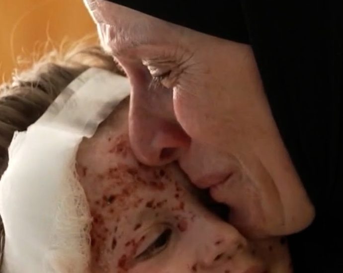 inside-a-beirut-hospital-treating-wounded-children