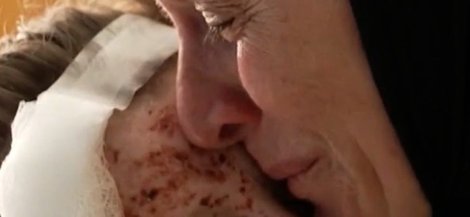 inside-a-beirut-hospital-treating-wounded-children