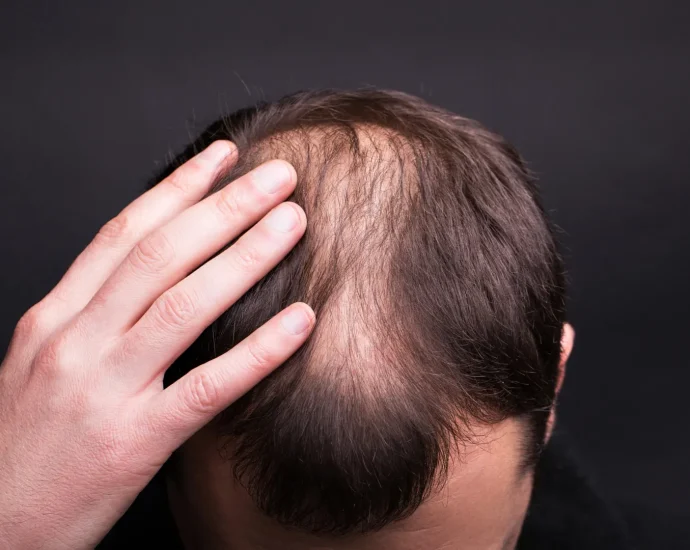textbooks-were-wrong:-scientists-reveal-the-surprising-way-human-hair-really-grows