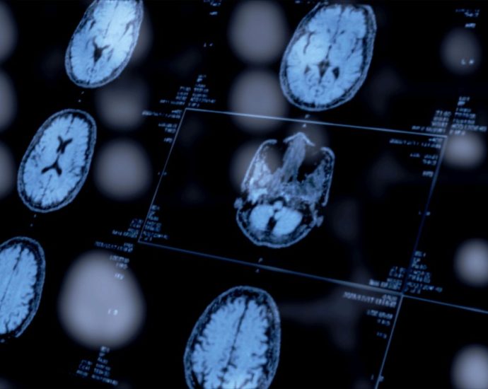 Psychiatrists’ Use of Biomarkers Could Open a New Window Into Mental Health Diagnoses