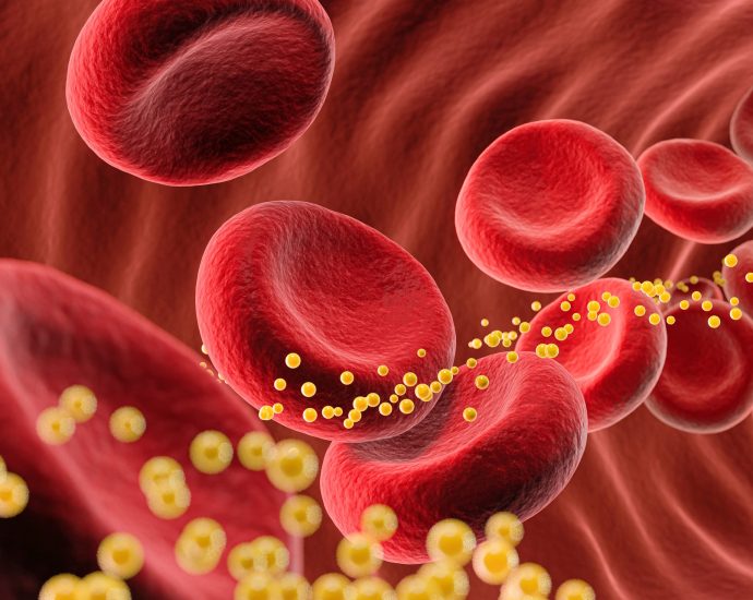 How Long Does It Take to Lower Cholesterol? Cardiologists Have the Exact Numbers.