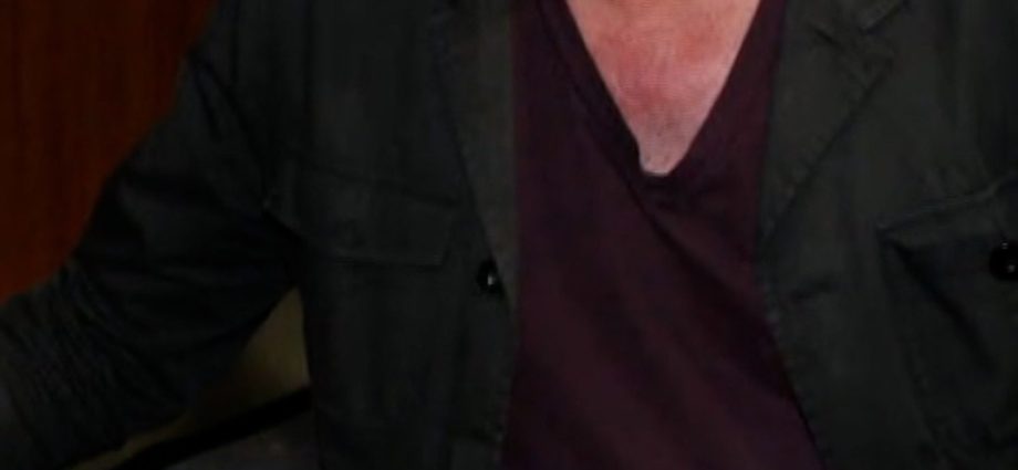 lindsey-buckingham-attacked-with-unknown-substance