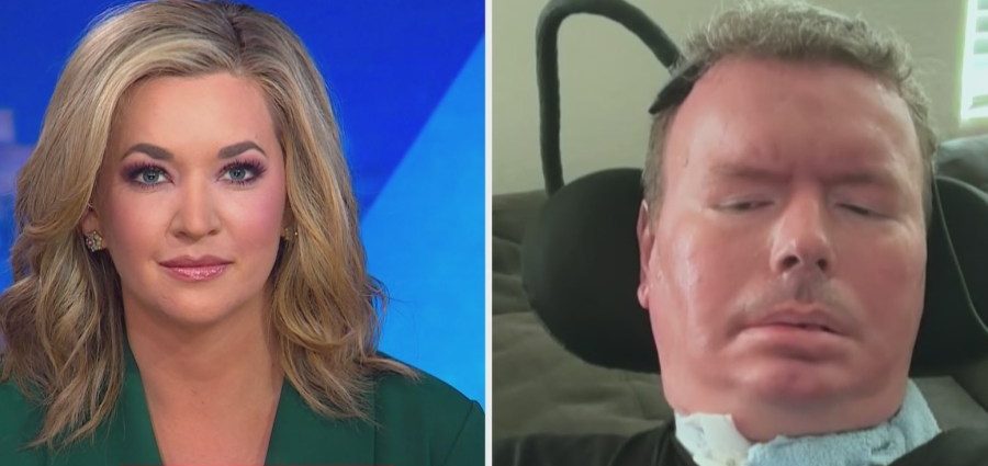 how-neuralink-brain-chip-transformed-life-of-als-sufferer