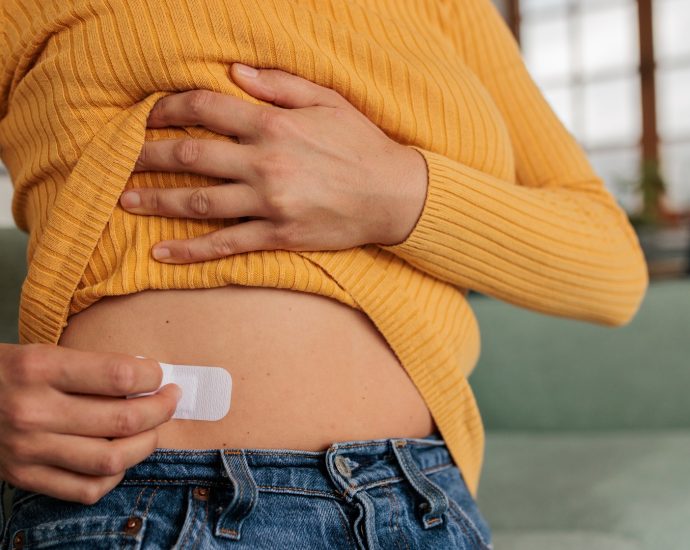 supplies-of-estrogen-patches-run-low-as-demand-surges