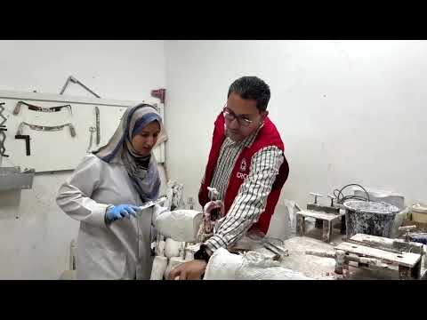 prosthetic-limbs-in-scarce-supply-for-gaza’s-amputees