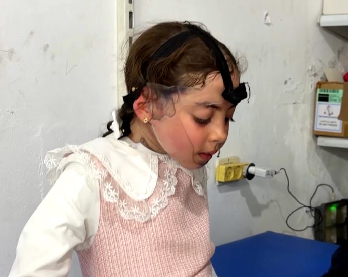 burn-treatment-for-gaza-children-threatened-by-israeli-restrictions