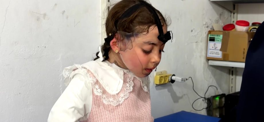 burn-treatment-for-gaza-children-threatened-by-israeli-restrictions