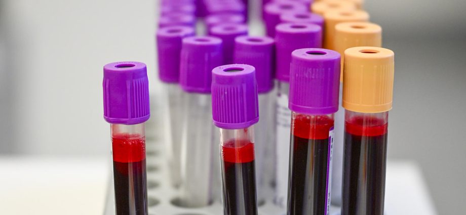 are-cancer-screening-blood-tests-close-to-prime-time?