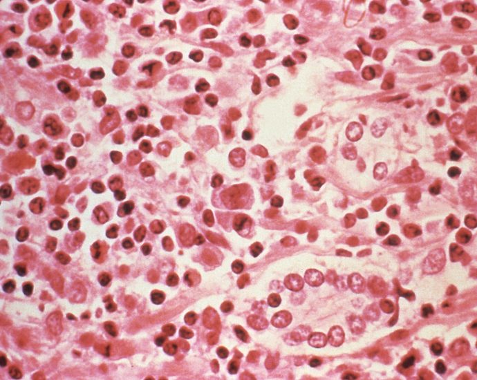 three-dead-in-suspected-hantavirus-outbreak-on-atlantic-cruise-ship