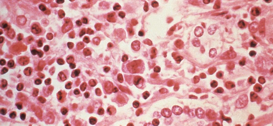 three-dead-in-suspected-hantavirus-outbreak-on-atlantic-cruise-ship