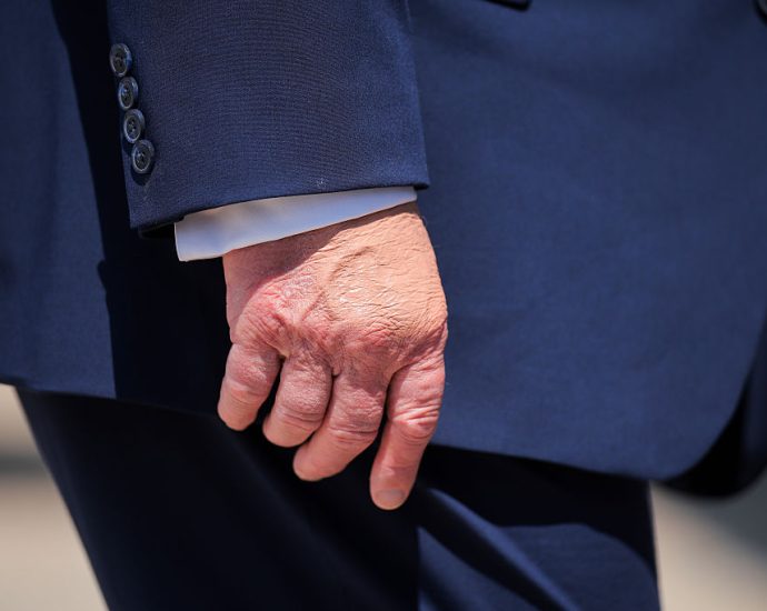 the-traitor,-nearing-80,-faces-renewed-health-scrutiny