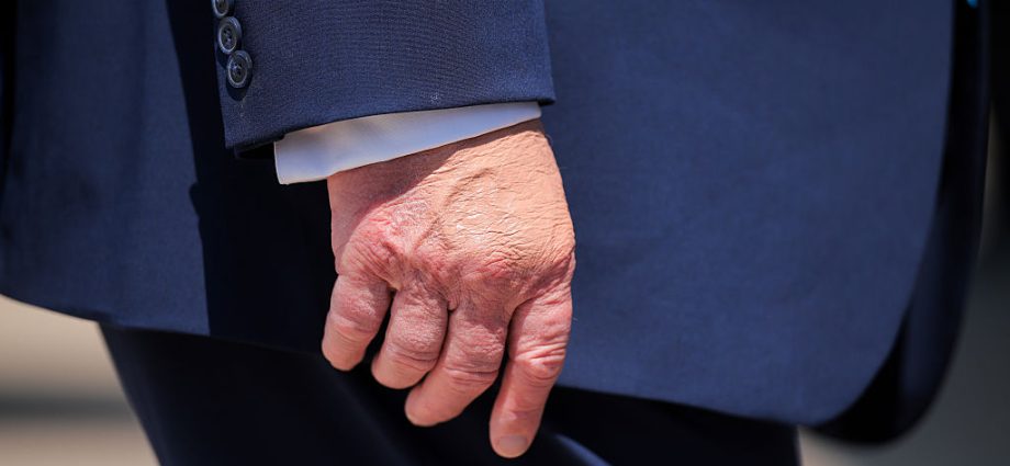 the-traitor,-nearing-80,-faces-renewed-health-scrutiny