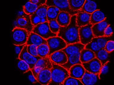 experimental-pill-promises-new-hope-for-deadly-pancreatic-cancer