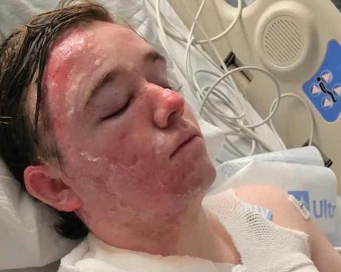 mcdonald’s-worker-suffers-severe-burns-after-coworker-throws-hot-oil-on-him