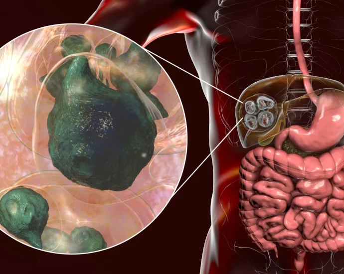 the-deadly-tapeworm-spreading-across-america-has-reached-the-pacific-northwest