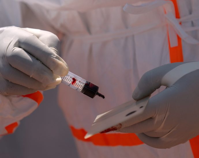 ebola-risk-for-world-cup-is-‘extremely-low’,-but-us-is-ready,-experts-say