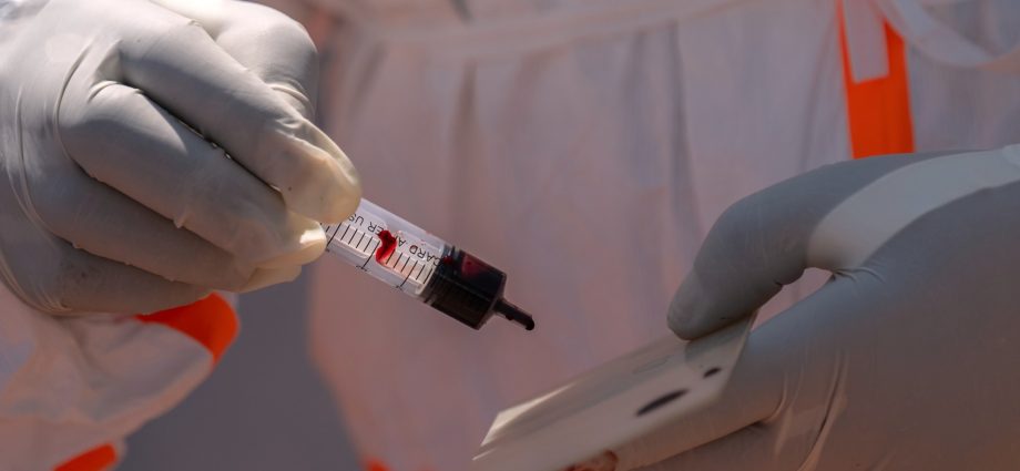 ebola-risk-for-world-cup-is-‘extremely-low’,-but-us-is-ready,-experts-say