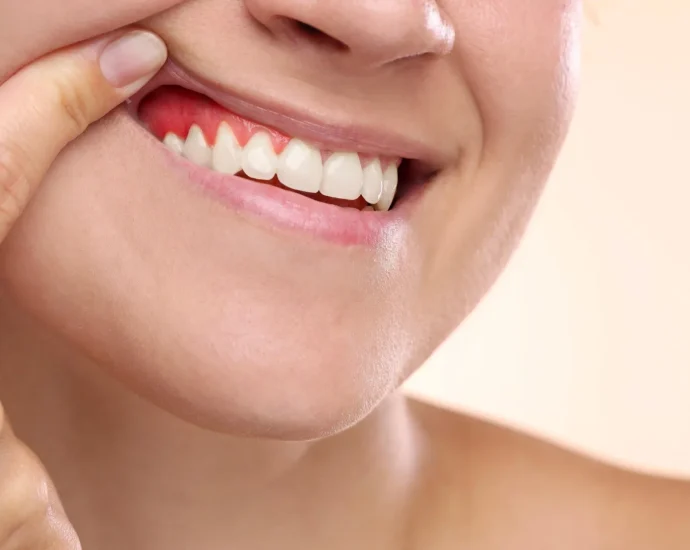this-giant-tropical-fruit-could-help-reverse-gum-disease-damage
