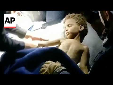 crew-rescues-a-3-year-old-boy-trapped-for-6-days-after-venezuela-earthquake