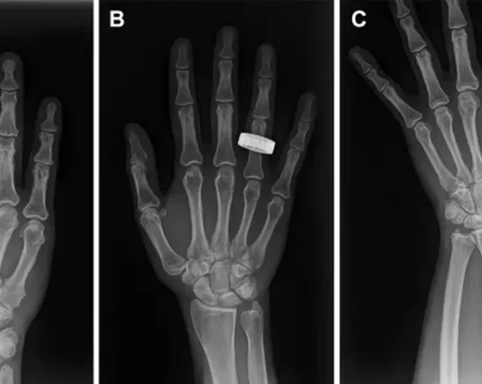 See the first X-rays of humans taken in space