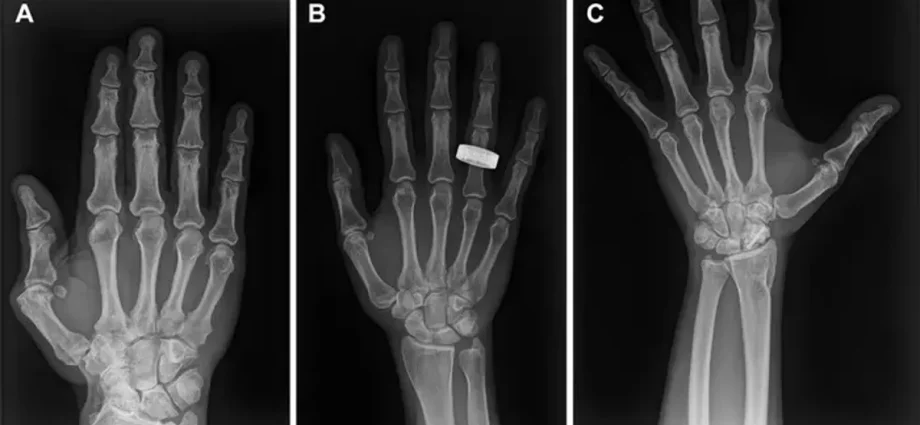 See the first X-rays of humans taken in space