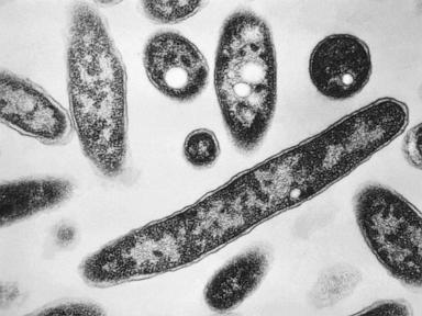 second-death-reported-in-legionnaires’-disease-outbreak-in-new-york-city