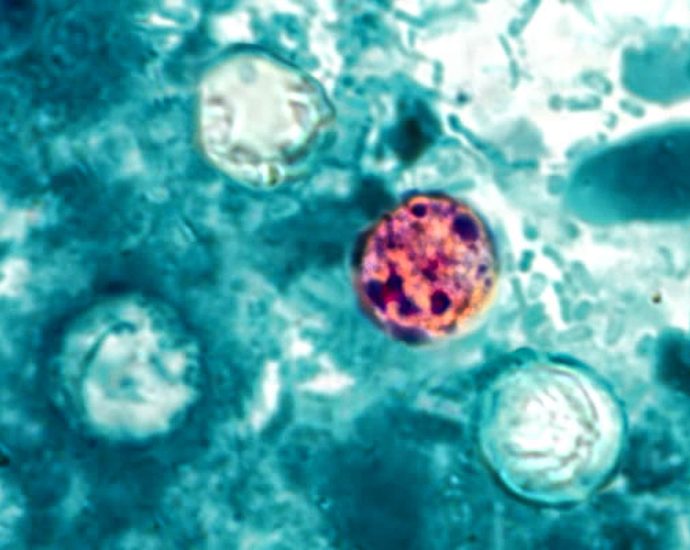 michigan-reports-2-deaths-in-cyclosporiasis-outbreak