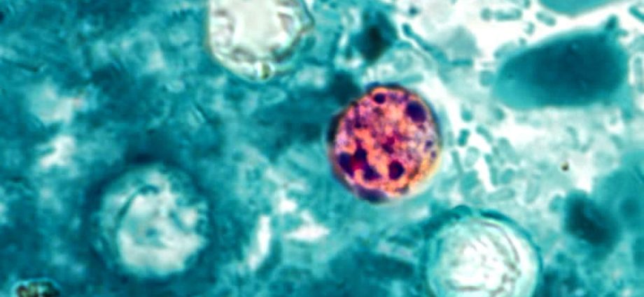 michigan-reports-2-deaths-in-cyclosporiasis-outbreak