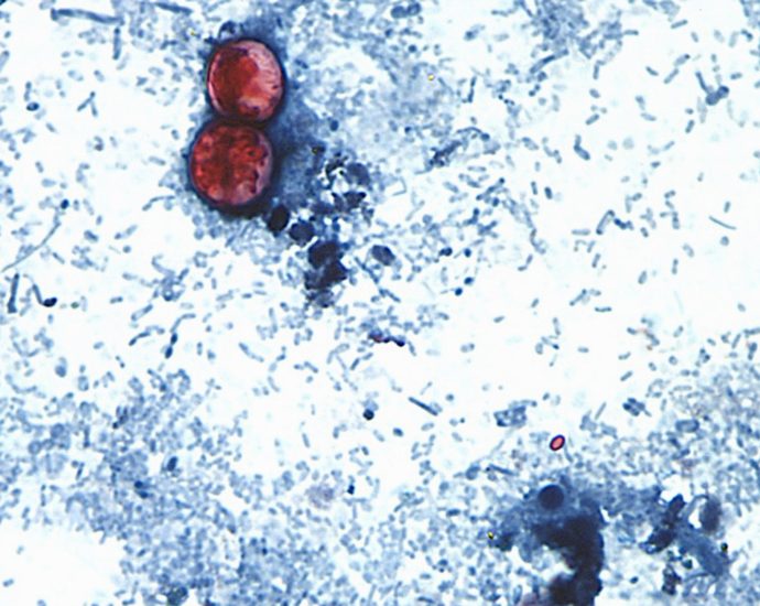 us-announces-first-two-deaths-from-cyclospora-outbreak