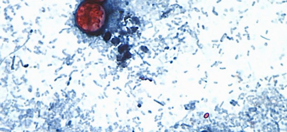 us-announces-first-two-deaths-from-cyclospora-outbreak