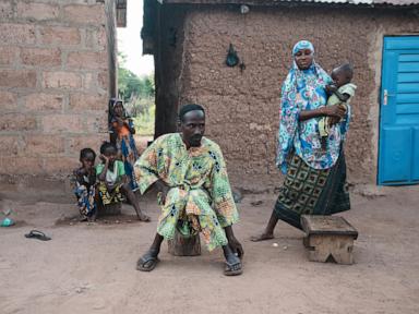 in-benin,-malnutrition-and-misinformed-views-contribute-to-widespread-stunting-in-children