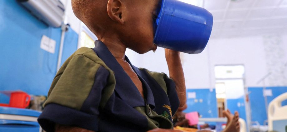somalia-child-hunger-crisis-deepens-after-aid-cuts,-unicef-says