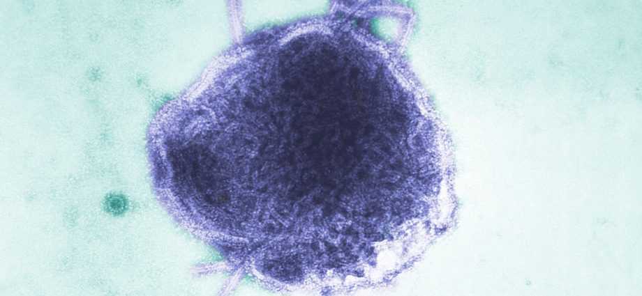 infant-in-pennsylvania-is-one-of-the-two-measles-deaths-reported-this-week