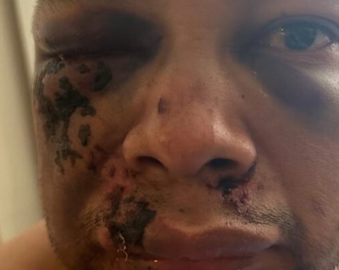 man-allegedly-beaten-by-ice-demands-police-treat-it-as-a-crime