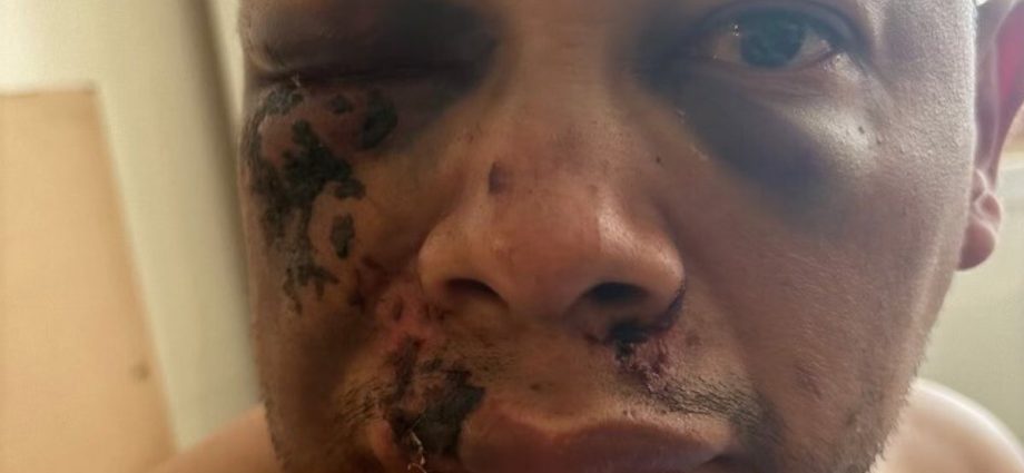 man-allegedly-beaten-by-ice-demands-police-treat-it-as-a-crime