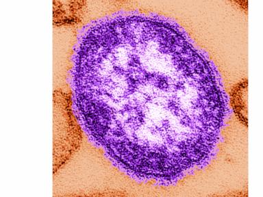 coroner-releases-details-of-infants-who-died-amid-growing-measles-outbreak