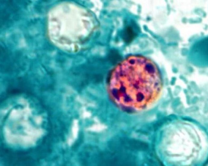 cyclosporiasis-outbreak-that-sickened-tens-of-thousands-officially-over,-cdc-says