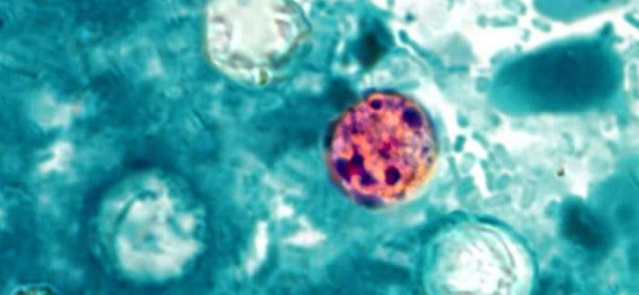 cyclosporiasis-outbreak-that-sickened-tens-of-thousands-officially-over,-cdc-says