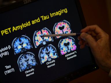 want-to-lower-your-risk-of-dementia?-it-doesn’t-involve-a-blood-test