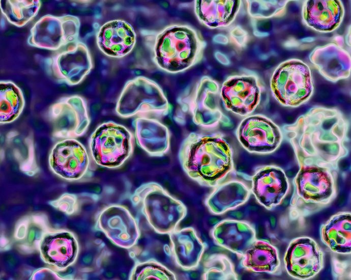 40-year-old-pennsylvania-woman-dies-from-measles-complications